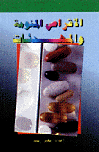 الأقراص المنومة والمهدئات